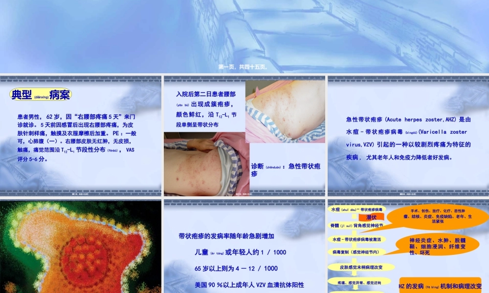 2022年医学专题—带状疱疹诊治(1).ppt