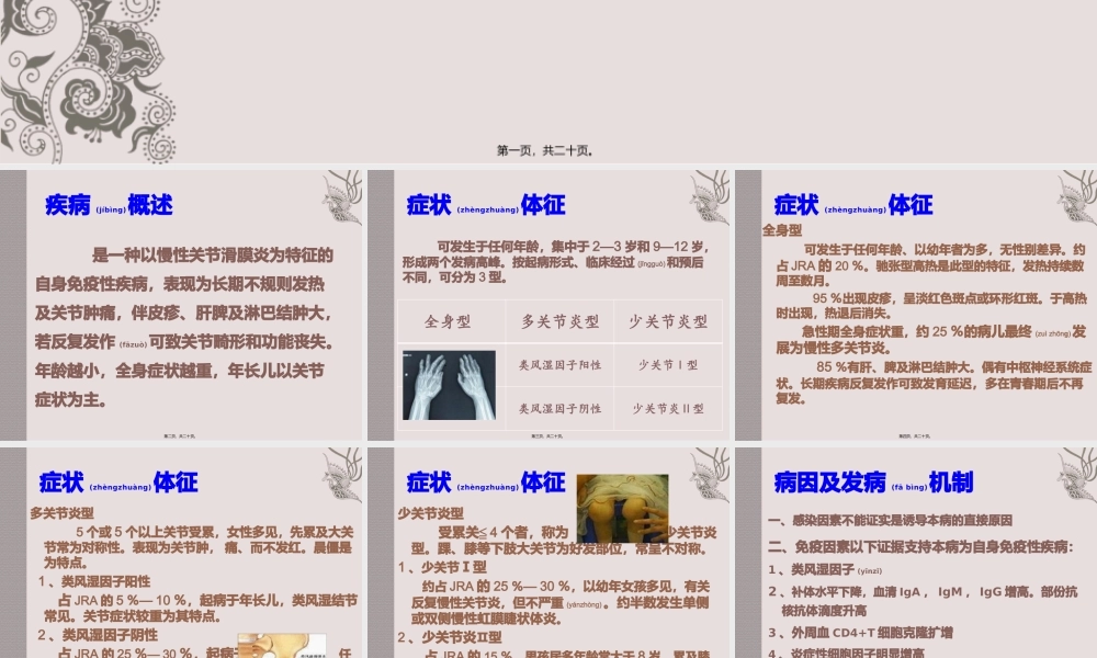 2022年医学专题—幼年性类风湿性关节炎(1).pptx