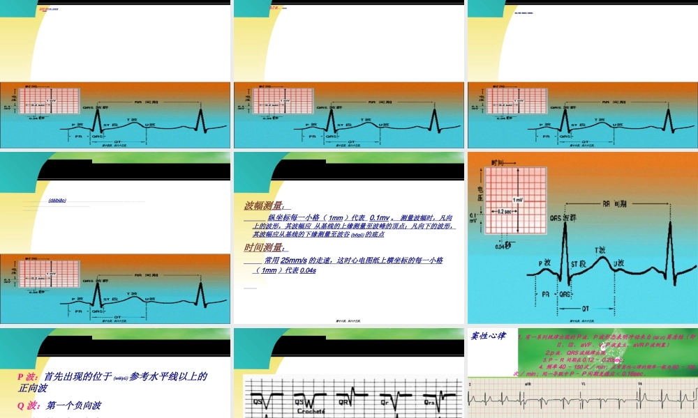 2022年医学专题—心电图与常见急救药品的应用(1).ppt