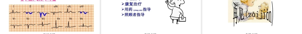 2022年医学专题—心绞痛与心肌梗死(1).ppt