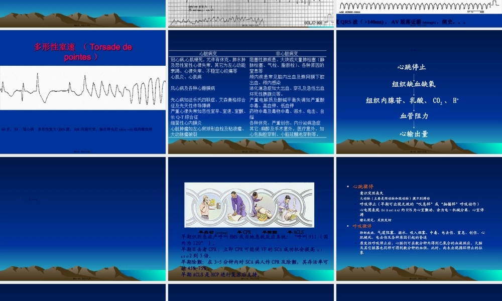 2022年医学专题—心肺脑复苏的进展(1).ppt