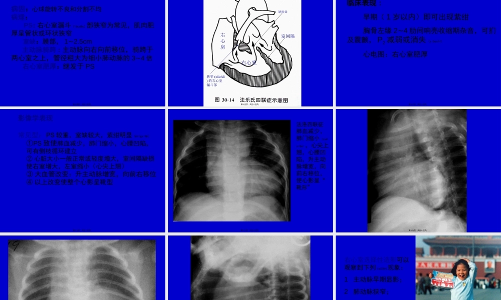 2022年医学专题—心脏大血管(1).ppt