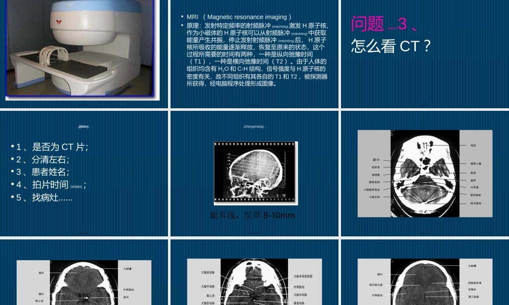 2022年医学专题—怎么看头颅CT与MRI(1).ppt