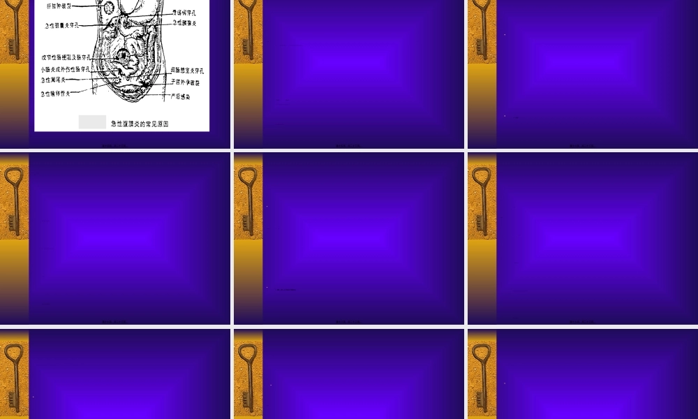 2022年医学专题—急性化脓性腹膜炎(1).ppt