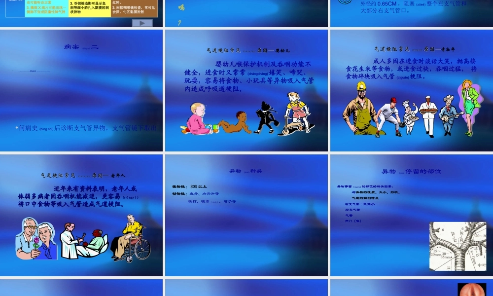 2022年医学专题—急性呼吸道梗阻(1).ppt