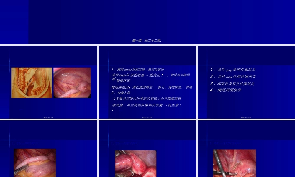 2022年医学专题—急性阑尾炎教学查房PPT(1).ppt