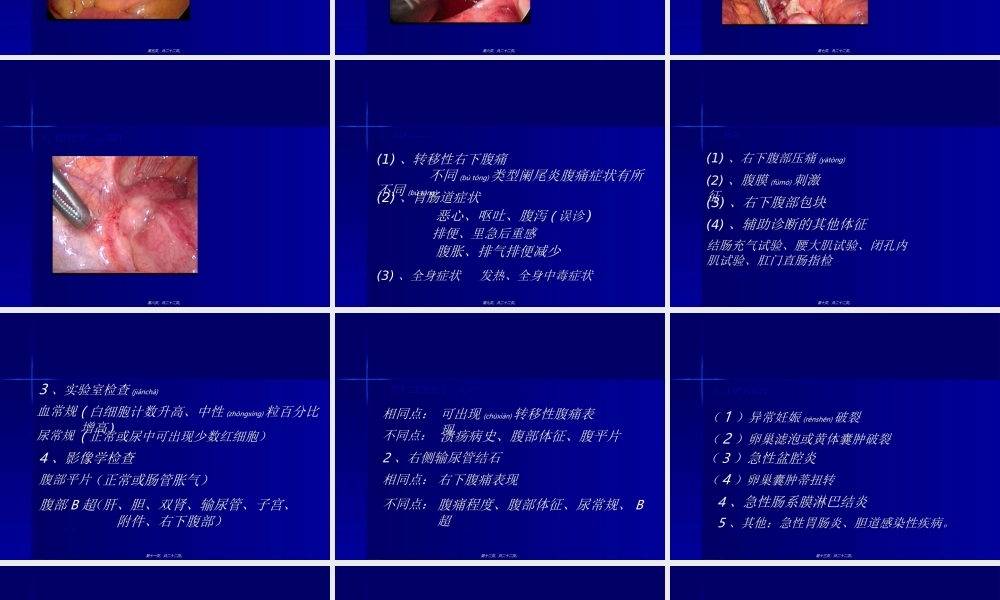 2022年医学专题—急性阑尾炎教学查房PPT(1).ppt