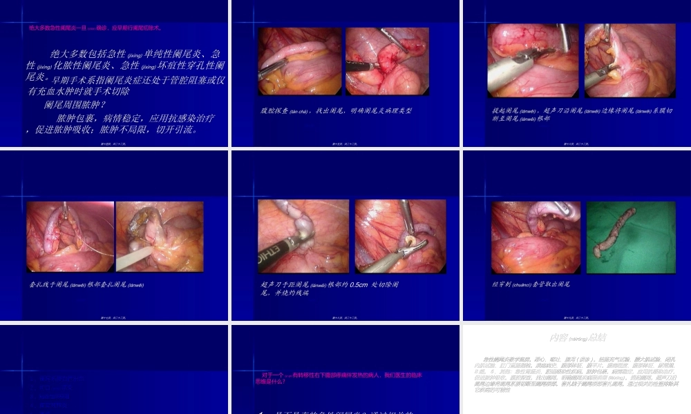 2022年医学专题—急性阑尾炎教学查房PPT(1).ppt