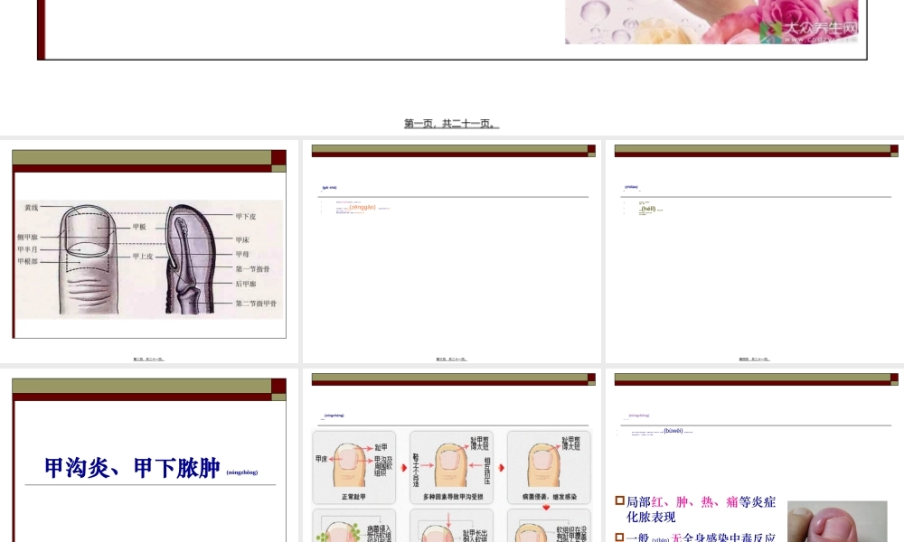 2022年医学专题—手化脓性感染(1).ppt