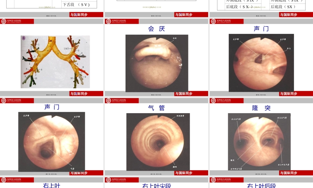 2022年医学专题—支气管镜下肺脏的分段(1).ppt