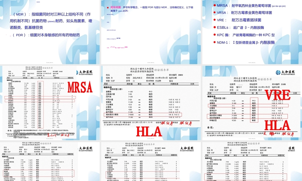 2022年医学专题—普通细菌培养-太和医院(1).ppt