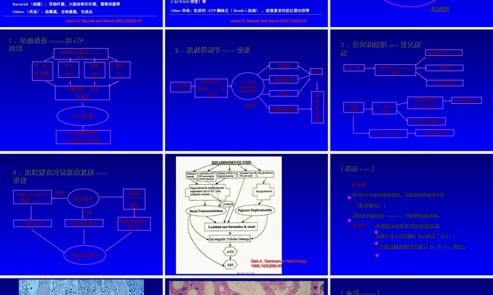 2022年医学专题—横纹肌溶解综合征的诊治进展(1).ppt
