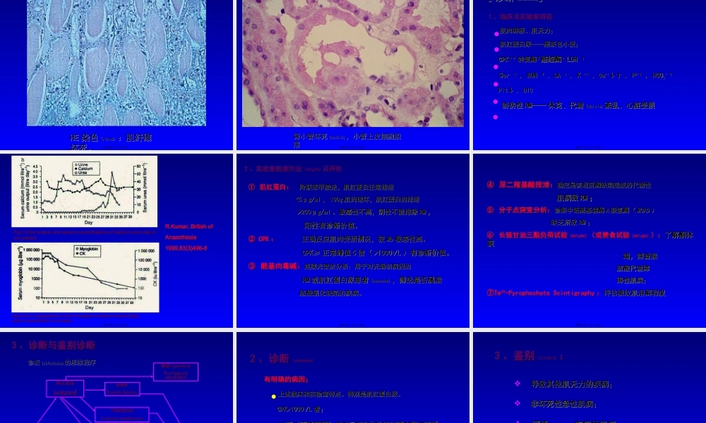 2022年医学专题—横纹肌溶解综合征的诊治进展(1).ppt