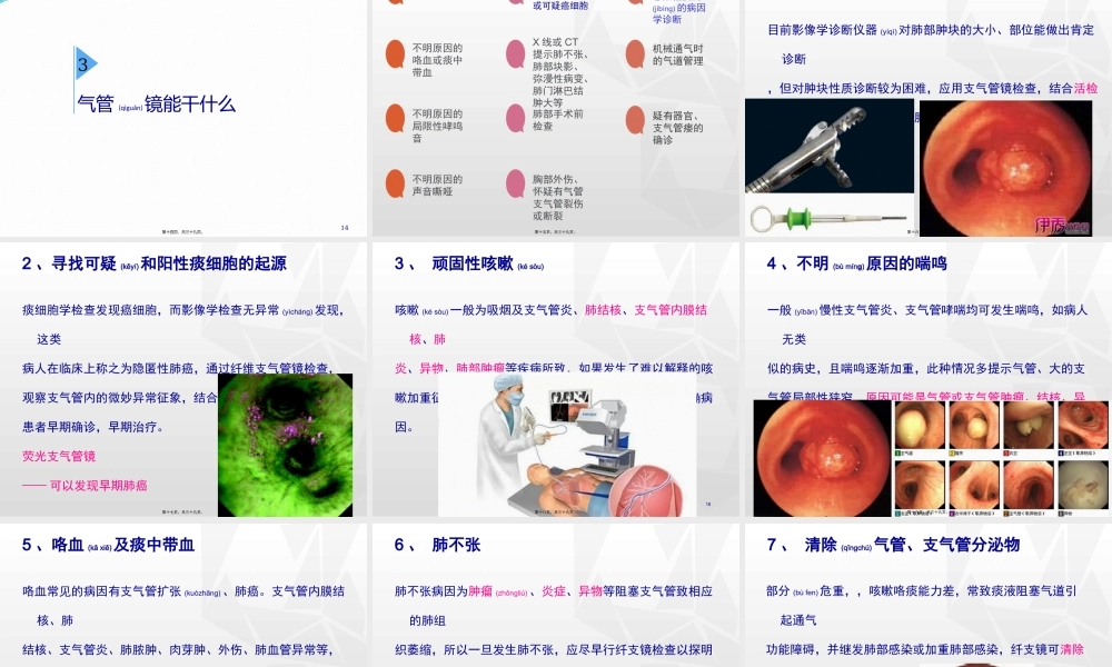 2022年医学专题—气管镜其实并不可怕-郝万明(1).pptx