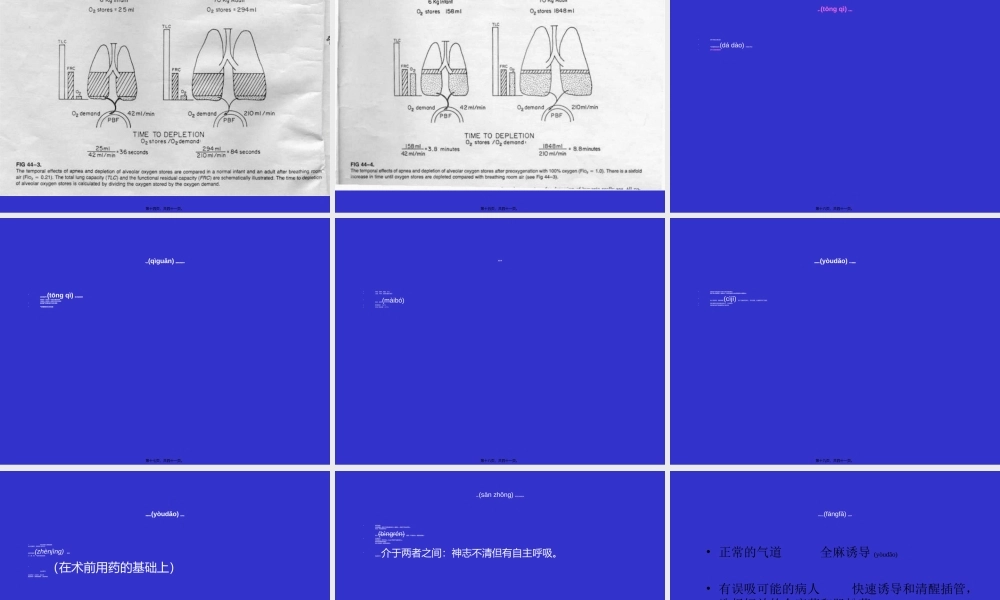 2022年医学专题—气管插管及困难(1).ppt