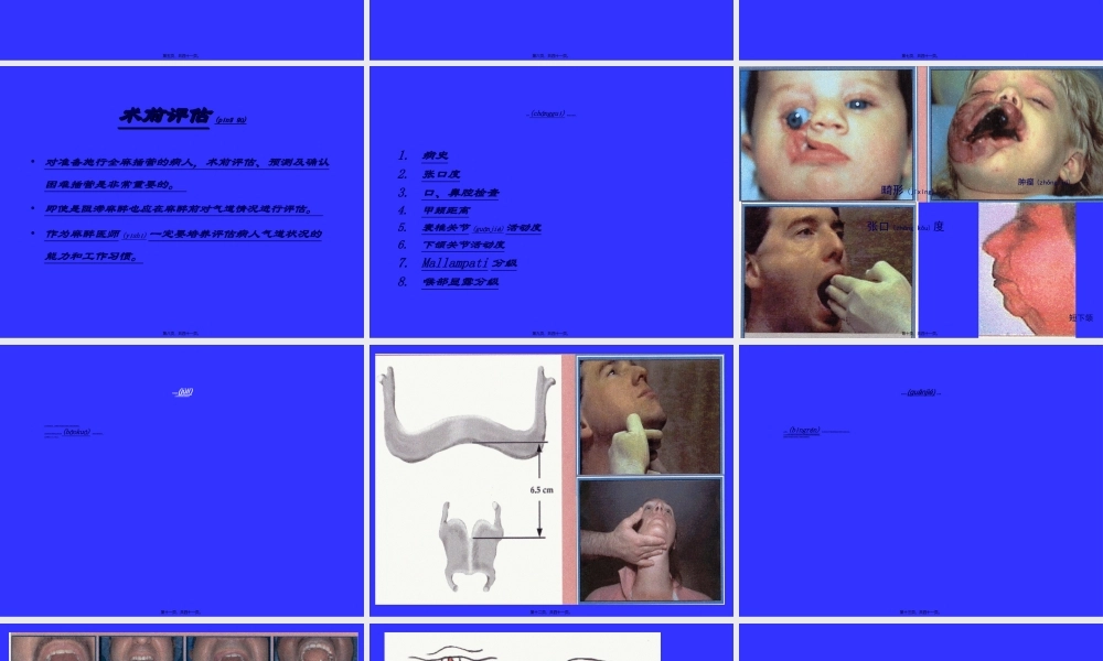 2022年医学专题—气管插管及困难气道的处理(1).ppt