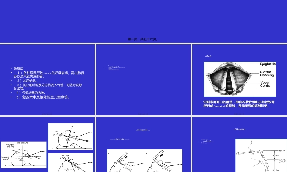 2022年医学专题—气管插管及困难1(1).ppt