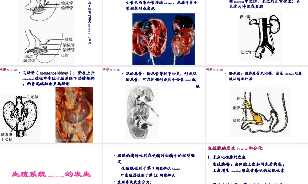 2022年医学专题—泌尿系统和生殖系统的发生(1).ppt