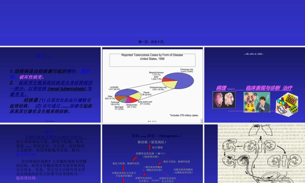 2022年医学专题—泌尿系结核(1).ppt
