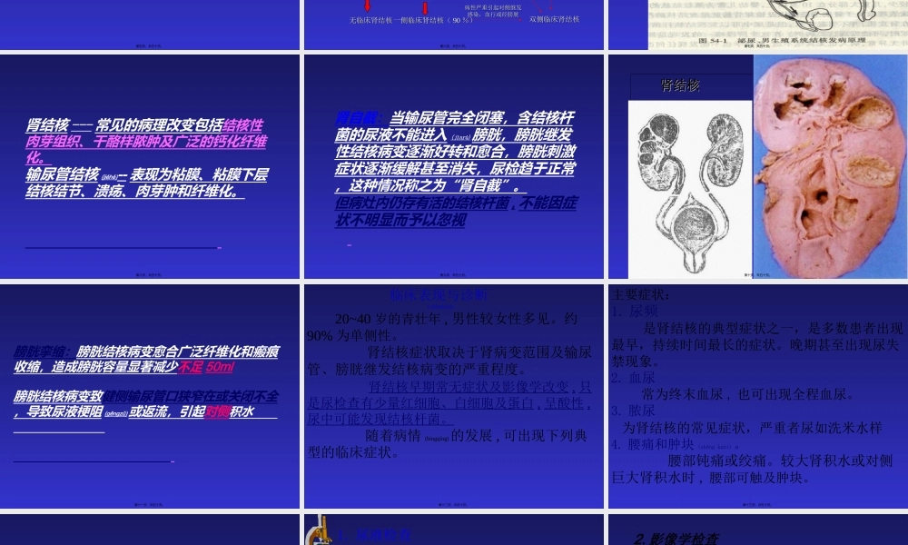 2022年医学专题—泌尿系结核(1).ppt