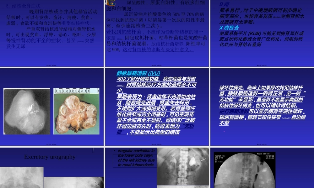 2022年医学专题—泌尿系结核(1).ppt