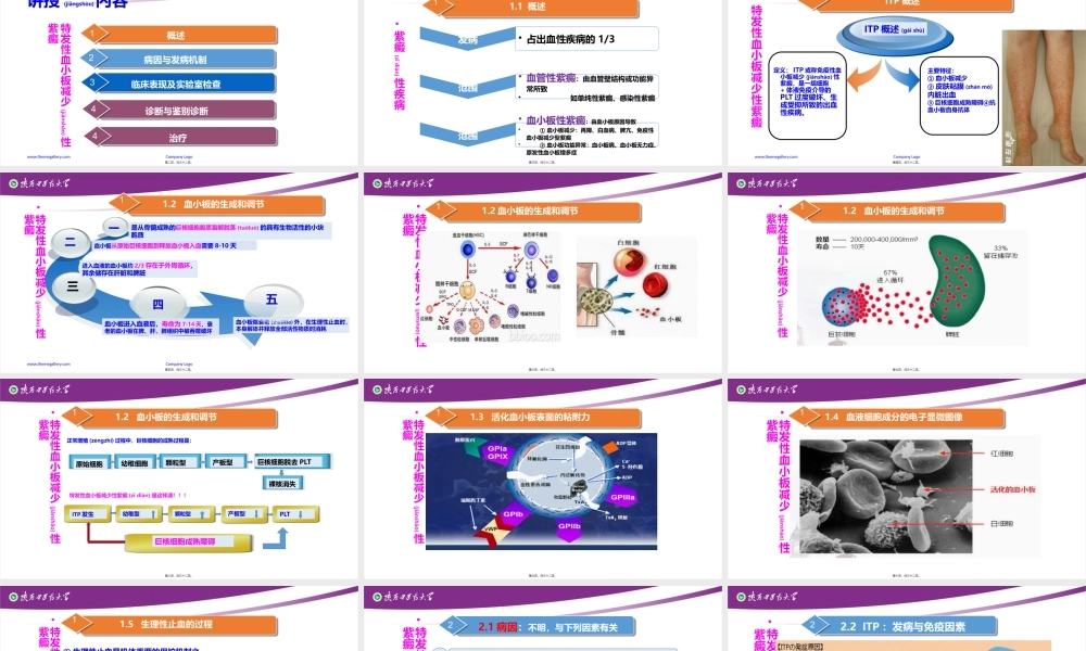 2022年医学专题—特发性血小板减少性紫癜(1).pptx