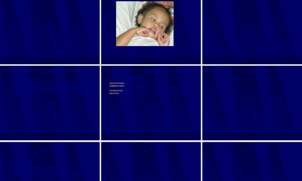 2022年医学专题—狂犬病-南宁第四人民医院(1).ppt