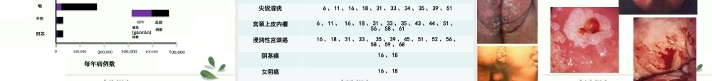 2022年医学专题—生育期女性HPV感染防治策略(1).pptx