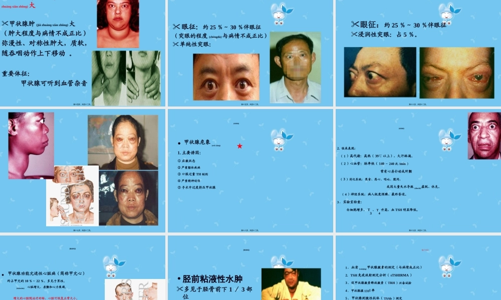 2022年医学专题—甲亢性心脏病病例讨论(1).ppt