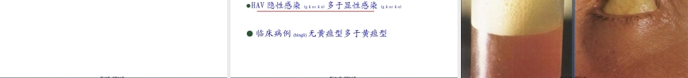 2022年医学专题—甲肝2014.10(1).ppt