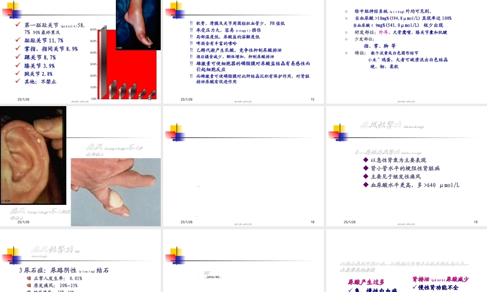 2022年医学专题—痛风的诊治进展(精)(1).ppt