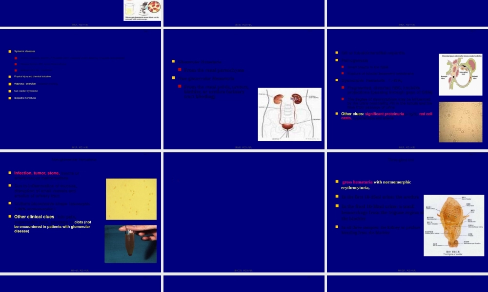 2022年医学专题—症状学12.尿频血尿(1).ppt