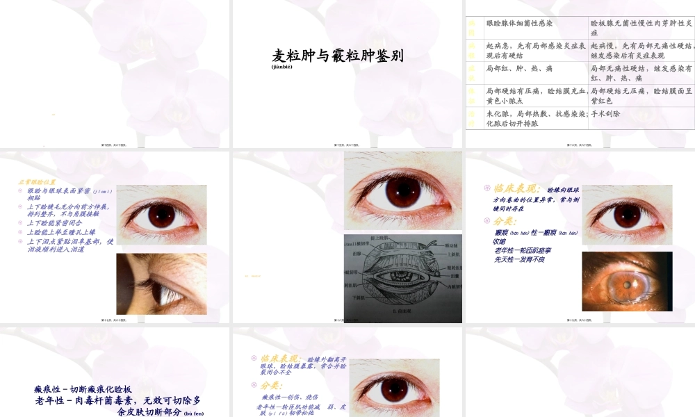 2022年医学专题—眼睑病-lgy(1).ppt