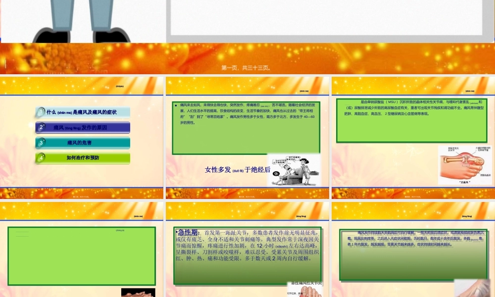 2022年医学专题—科普小知识——痛风(1).ppt