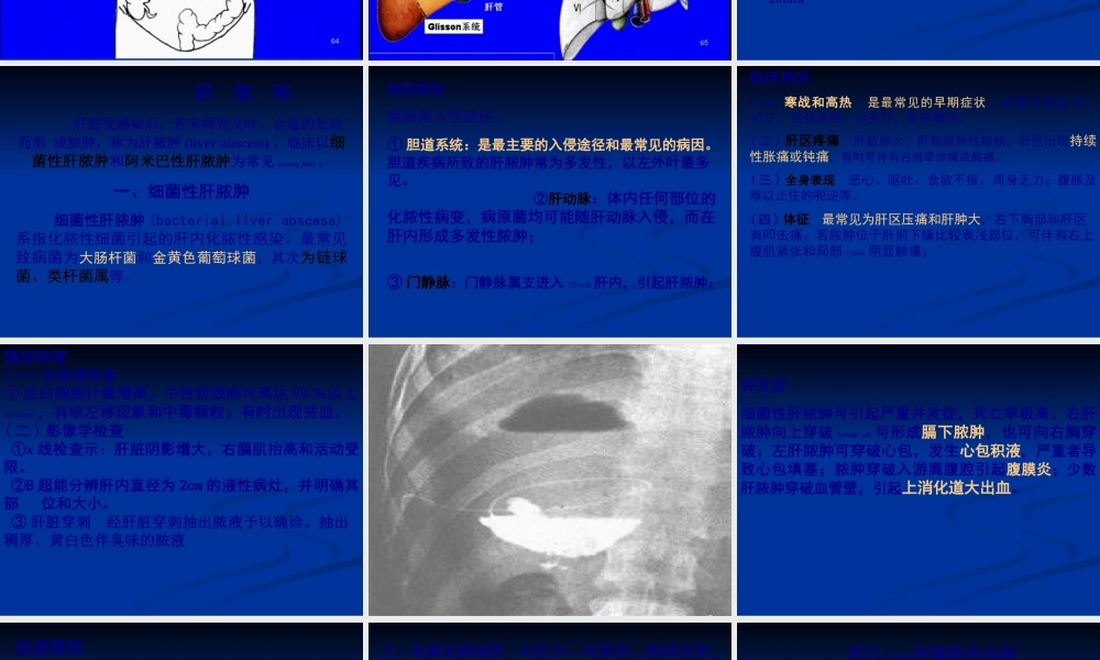 2022年医学专题—称为肝脓肿liverabscess(1).ppt