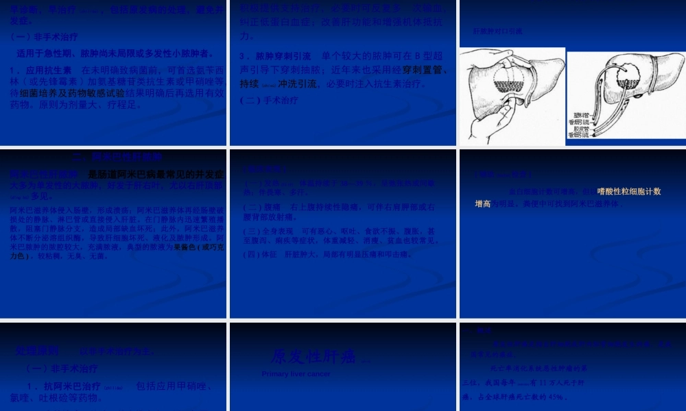 2022年医学专题—称为肝脓肿liverabscess(1).ppt