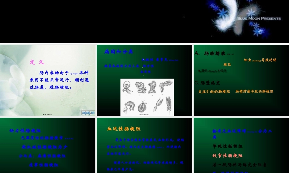 2022年医学专题—第五版-肠梗阻(1).ppt