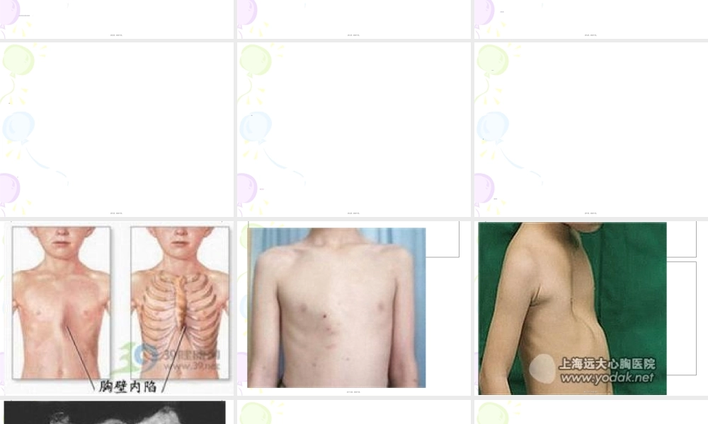 2022年医学专题—第五章--胸部.第二节-胸壁1ppt(1).ppt