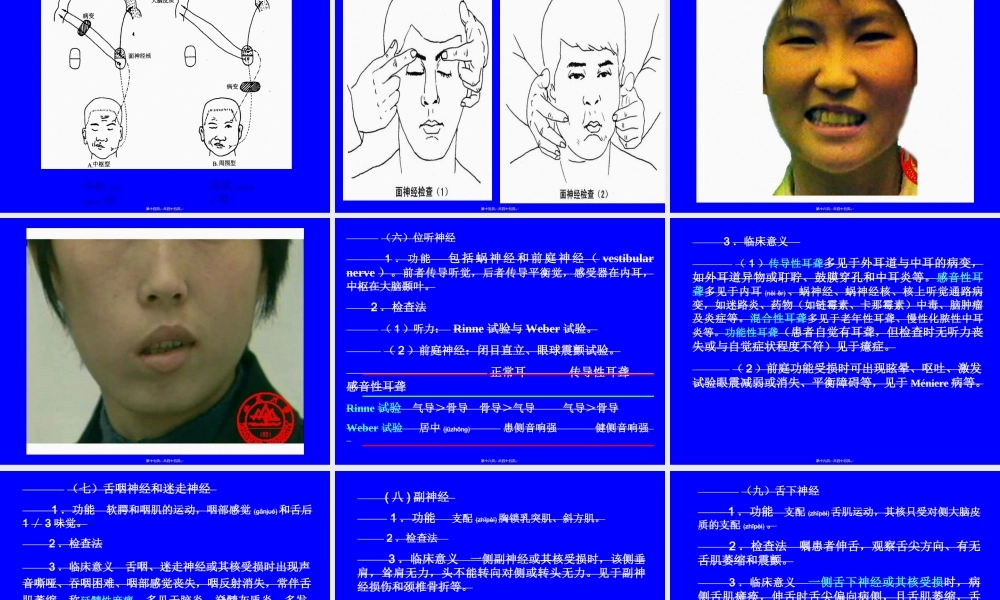 2022年医学专题—第十一章-神经系统检查-一、脑神经检查-脑神经共12对.单纯感.(1).ppt