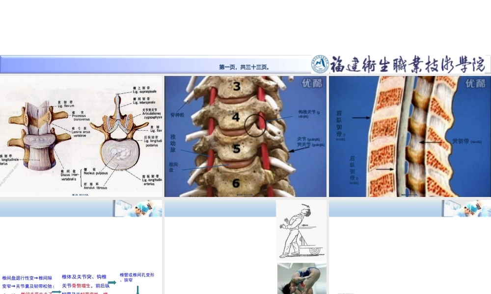 2022年医学专题—第十九章-第六节-颈椎病ppt(1).ppt