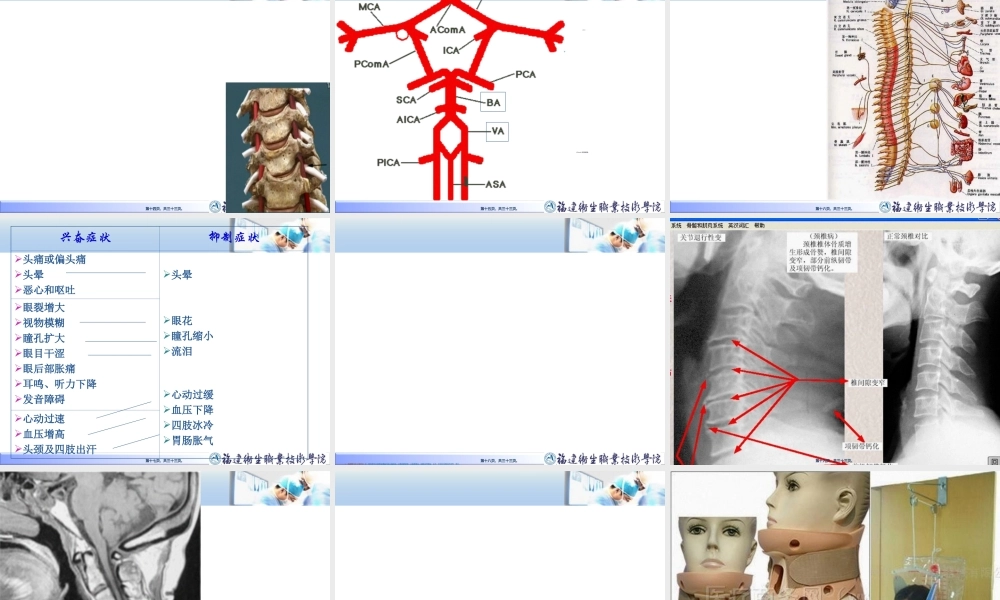 2022年医学专题—第十九章-第六节-颈椎病ppt(1).ppt