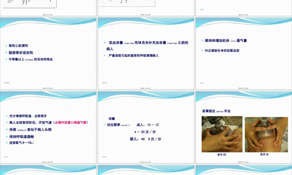 2022年医学专题—简易呼吸器(1).ppt