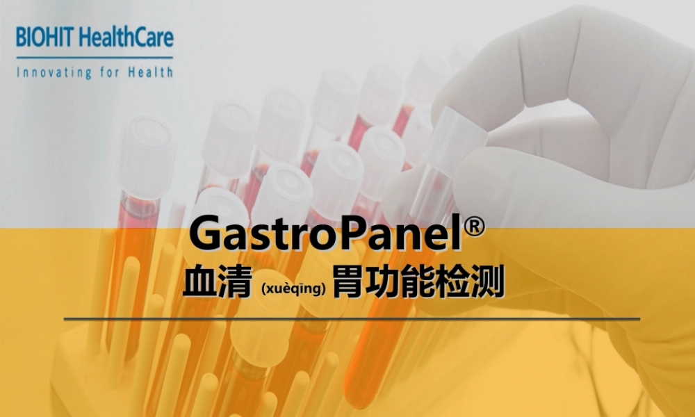 2022年医学专题—简版血清胃功能检测---简易版(1).ppt