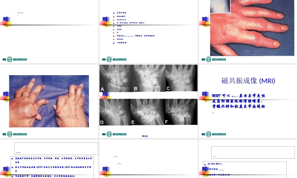2022年医学专题—类风湿关节炎幻灯(1).ppt