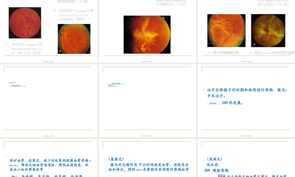 2022年医学专题—糖尿病性视网膜病变防治(1).ppt