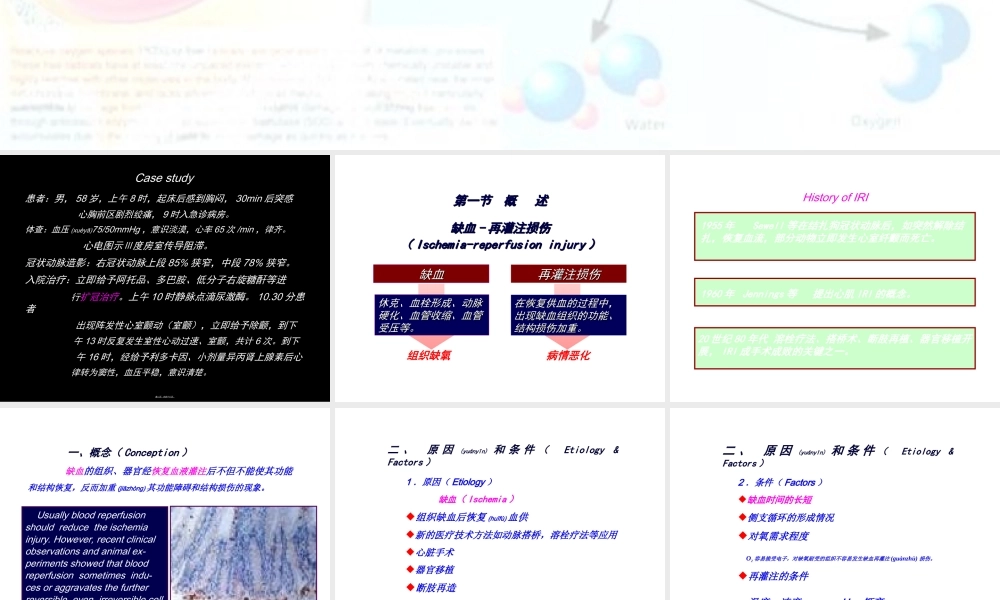 2022年医学专题—缺血再灌注损伤PPT(1).ppt