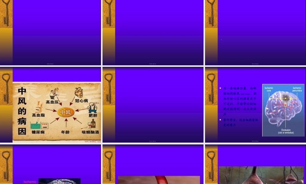 2022年医学专题—缺血性脑卒中(1).ppt