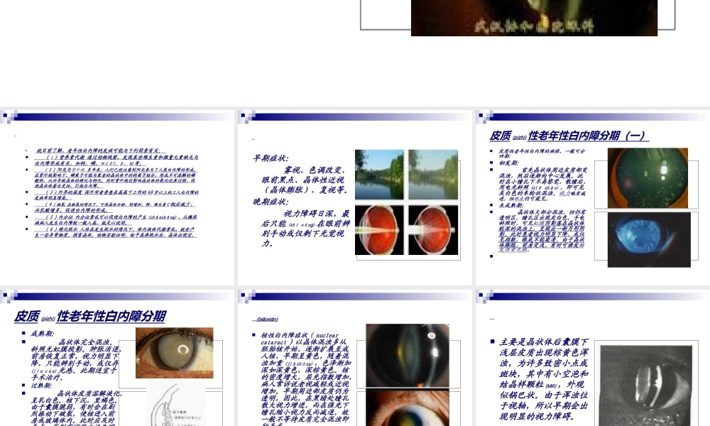 2022年医学专题—老年性白内障的诊(1).ppt