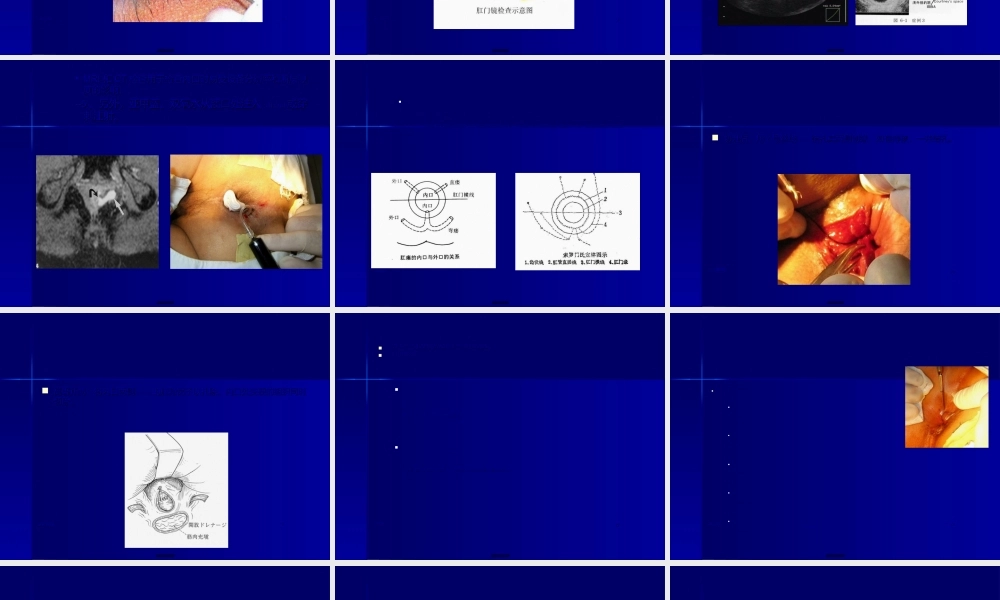 2022年医学专题—肛管直肠周围脓肿切开挂线术中的若干细节问题(1).ppt