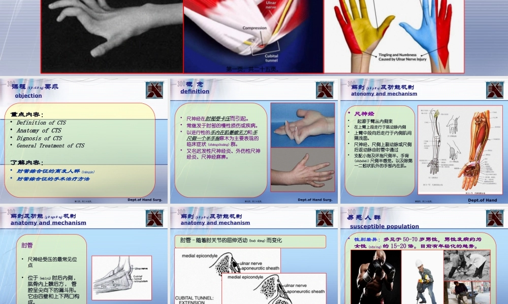 2022年医学专题—肘管综合症(1).pptx